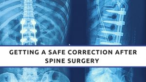 surgery